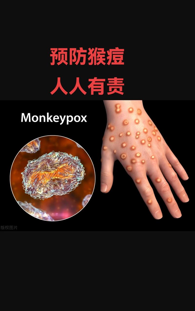 最新疫情防控消息〃最新疫情防控消息通知-第3张图片